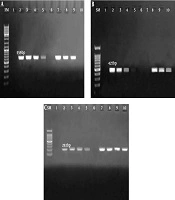 Cover image of the article: Prevalence of blaCTX-M, blaSHV, and blaTEM Genes in Escherichia coli Strains Isolated From Urinary Tract Infection Samples of Patients in the Intensive Care Unit in Qom, Iran