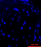 Does Phenytoin Have Neuroprotective Role and Affect Biocompatibility of Decellularized Sciatic Nerve Scaffold?