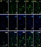 Effect of Aerobic Training and Octopamine Supplementation on the Expression of Octopamine Receptors in the Visceral Adipose Tissue of Rats Exposed to Deep Fried Oils
