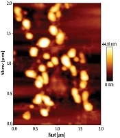 Isolation and Characterization of Exosomes Derived From Breast Cancer MDA-MB-231 Cell Line