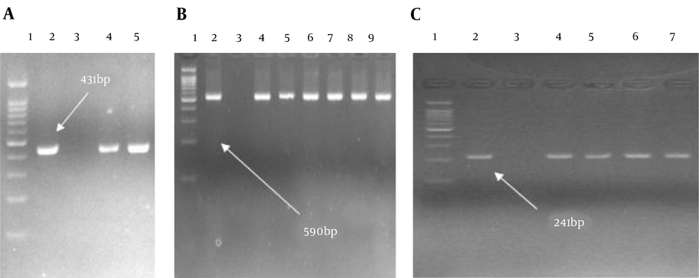 Gel electrophoresis shows the PCR products of <i>bla </i><sub><i>TEM</i></sub>, <i>bla </i><sub><i>SHV</i></sub>, and <i>bla </i><sub><i>CTX-M</i></sub> (A, Lane 1, DNA ladder 100 bp; Lane 2, control positive of <i>bla </i><sub><i>TEM</i></sub>; Lane 3, control negative of <i>bla </i><sub><i>TEM</i></sub>; Lanes 4 and 5, clinical isolates carrying <i>bla </i><sub><i>TEM</i></sub>; B, Lane 1, DNA ladder 100 bp; Lane 2, control positive of <i>bla </i><sub><i>CTX-M</i></sub>; Lane 3, control negative of <i>bla </i><sub><i>CTX-M</i></sub>; Lanes 4 - 9, clinical isolates carrying <i>bla </i><sub><i>CTX-M</i></sub>. C; Lane 1, DNA ladder 100 bp; Lane 2, control positive of <i>bla </i><sub><i>SHV</i></sub>, Lane 3; control negative of <i>bla </i><sub><i>SHV</i></sub>; Lanes 4 - 7, clinical isolates carrying <i>bla </i><sub><i>SHV</i></sub>). Gel electrophoresis shows the PCR products of <i>bla </i><sub><i>TEM</i></sub>, <i>bla </i><sub><i>SHV</i></sub>, and <i>bla </i><sub><i>CTX-M</i></sub> (A, Lane 1, DNA ladder 100 bp; Lane 2, control positive of <i>bla </i><sub><i>TEM</i></sub>; Lane 3, control negative of <i>bla </i><sub><i>TEM</i></sub>; Lanes 4 and 5, clinical isolates carrying <i>bla </i><sub><i>TEM</i></sub>; B, Lane 1, DNA ladder 100 bp; Lane 2, control positive of <i>bla </i><sub><i>CTX-M</i></sub>; Lane 3, control negative of <i>bla </i><sub><i>CTX-M</i></sub>; Lanes 4 - 9, clinical isolates carrying <i>bla </i><sub><i>CTX-M</i></sub>. C; Lane 1, DNA ladder 100 bp; Lane 2, control positive of <i>bla </i><sub><i>SHV</i></sub>, Lane 3; control negative of <i>bla </i><sub><i>SHV</i></sub>; Lanes 4 - 7, clinical isolates carrying <i>bla </i><sub><i>SHV</i></sub>).