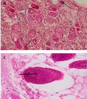 Cover image of the article: Effect of Topical Grape Sap on Apoptosis in Hair Follicle Among Male Rats