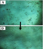 Evaluation of the Synergistic Effects of Ciprofloxacin and Low-Power Laser on Apoptosis, Cell Viability, and Reactive Oxygen Species Levels in Skin Cancer (A375 Cancer Cells)