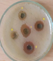 Cover image of the article: Evaluation of Antimicrobial Activity of Several Medicinal Plants Against Clinically Isolated Staphylococcus aureus from Humans and Sheep