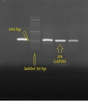 Cover image of the article: Evaluation of NLR Family CARD Domain Containing 3 and NLR Family CARD Domain Containing 5 Gene Expression in Interferon Gamma–Treated Mesenchymal Stem Cells from Wharton’s Jelly of Human Umbilical Cord