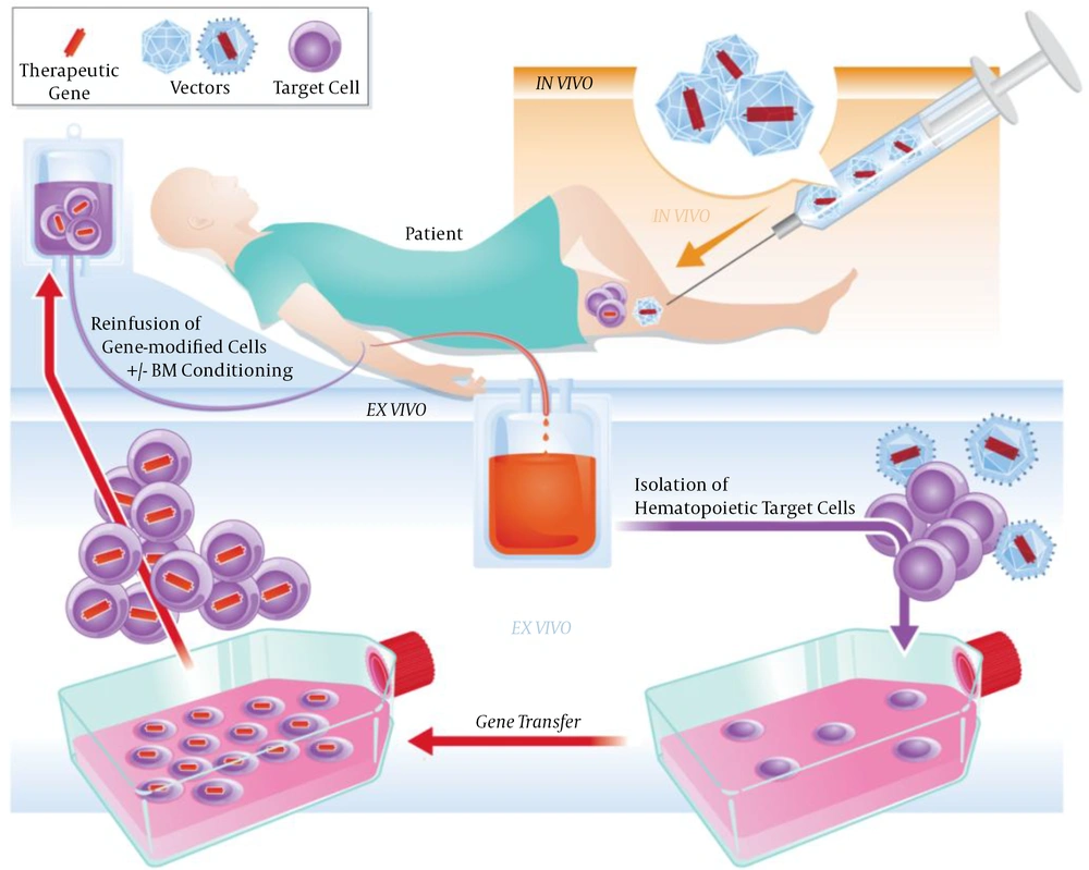 In vivo and ex vivo gene therapy concepts (2). In the in vivo technique, the therapeutic gene is introduced directly into the body, while in the ex vivo, the patient’s cells are extracted from the body, genetically modified outside the body, and then transferred into the patient. In vivo and ex vivo gene therapy concepts (2). In the in vivo technique, the therapeutic gene is introduced directly into the body, while in the ex vivo, the patient’s cells are extracted from the body, genetically modified outside the body, and then transferred into the patient.