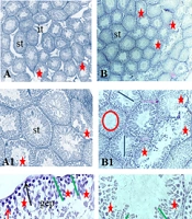 Synergic Effects of Rosemary Extract and Aerobic Exercise on Sperm Parameters and Testicular Tissue in an Aged Rat Model