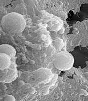 Comparison of Biocompatibility and Morphology of PC12 Cell Line on a Polycaprolactane/Silymarin Scaffold and a Polycaprolactane/Tragacanth Scaffold