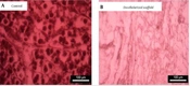 Evaluating the Biocompatibility of Decellularized Pancreas and Its Histological Features as a Support Structure for Adipose Mesenchymal Stem Cell Culture