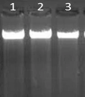 Investigating Common Mutations in Exon 20 and 21 of EGFR Gene in Lung Cancer Tumor Tissue of NSCLC Type