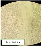 The Effect of Supernatant Culture Medium Isolated from 3T3-L1 Cells Subjected to Low Power 980 and 650 nm Laser Radiation on Wound Healing Process