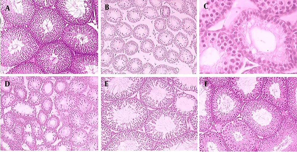 Histological sections of testis (Hematoxylin-Eosin staining) in control group, A, ×40, 5-fluorouracil (5-FU); B, ×20; and C, ×40, 5-FU along with 50 mg/kg taurine (TAU); D, ×20, 5-FU along with 100 mg/kg TAU; E, ×40 5-FU along with 200 mg/kg TAU; F, ×40 treated male Wistar rats. Histological sections of testis (Hematoxylin-Eosin staining) in control group, A, ×40, 5-fluorouracil (5-FU); B, ×20; and C, ×40, 5-FU along with 50 mg/kg taurine (TAU); D, ×20, 5-FU along with 100 mg/kg TAU; E, ×40 5-FU along with 200 mg/kg TAU; F, ×40 treated male Wistar rats.