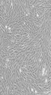 Cover image of the article: Prospect of Mesenchymal Stem Cells Conditioned Medium in Tissue Regeneration