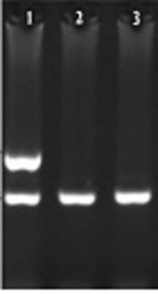 Analysis of HLA-A*03 in Multiple Sclerosis Patients in Khuzestan Province, Iran