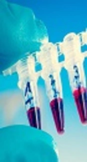 Cover image of the article: Calculating Sensitivity, Specificity and Predictive Values for Medical Diagnostic Tests