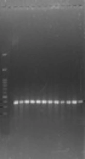 Study of Prevalence of Toxic Shock Syndrome Toxin (<i>TSST-1</i>) and Methicilin Resistance (<i>MecA</i>) Genes of <i>Staphylococcus aureus</i> Isolates from Local Cheese in Northwest of Iran