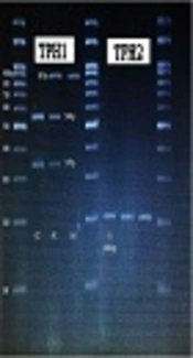 Cover image of the article: Association Study of TPH1 (rs1800532) and TPH2 (rs4570625) Polymorphisms in Type 1 Bipolar Disorder in Iran