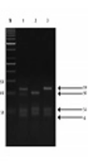 The Catechol-Methyltransferase rs4680 G>A Polymorphism is Associated with Uterine Leiomyoma Susceptibility