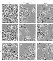 Inhibition of Cervical Cancer Cell Line Hela by Human Wharton’s Jelly Stem Cells Through Induction of Apoptosis