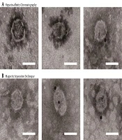 Two New Purification Methods of Hepatitis C Virus Particles from Serum-Free Culture System
