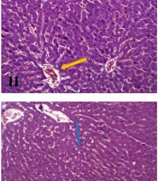 An Efficient Model of Non-alcoholic Fatty Liver Disease (NAFLD) Versus Current Experimental Models: Effects of Fructose, Fat, and Carbon Tetrachloride on NAFLD