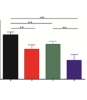 Dicer Inhibits Hepatocellular Carcinoma by Inhibiting the Interleukin 6 Pathway