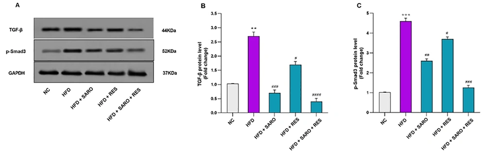Protein expression levels of transforming growth factor-beta 1 (TGF-β) and P-Smad3. Glyceraldehyde 3-phosphate dehydrogenase (GAPDH) was used as the loading control. Protein levels of p-Smad3 in control and treated cells were quantified using ImageJ software (v1.52) and normalized to GAPDH band intensity. Values are expressed as mean ± standard deviation (SD). Significant differences between HFD and NC (P < 0.05) are indicated by *, and significant differences between HFD and other groups are indicated by #P < 0.05, ##P < 0.01, ###P < 0.001, and ####P < 0.0001. NC, control group; HFD, high-fat diet; SARO, saroglitazar; RES, resveratrol; TGF-β1, transforming growth factor-beta 1; GAPDH, glyceraldehyde 3-phosphate dehydrogenase. Protein expression levels of transforming growth factor-beta 1 (TGF-β) and P-Smad3. Glyceraldehyde 3-phosphate dehydrogenase (GAPDH) was used as the loading control. Protein levels of p-Smad3 in control and treated cells were quantified using ImageJ software (v1.52) and normalized to GAPDH band intensity. Values are expressed as mean ± standard deviation (SD). Significant differences between HFD and NC (P < 0.05) are indicated by *, and significant differences between HFD and other groups are indicated by #P < 0.05, ##P < 0.01, ###P < 0.001, and ####P < 0.0001. NC, control group; HFD, high-fat diet; SARO, saroglitazar; RES, resveratrol; TGF-β1, transforming growth factor-beta 1; GAPDH, glyceraldehyde 3-phosphate dehydrogenase.