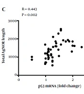 Non-Alcoholic Steatohepatitis and Autoimmune Hepatitis Cirrhosis May Have a Higher Risk of Progression to Hepatocellular Carcinoma
