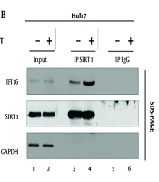 Sirtuin 1 Dynamic Interplay of IFI16 and STING Interferon-Stimulated Gene Regulate Hepatitis B Virus Replication