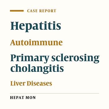 Type II Autoimmune Hepatitis and Small Duct Sclerosing Cholangitis in a Seven Years Old Child: An Overlap Syndrome?