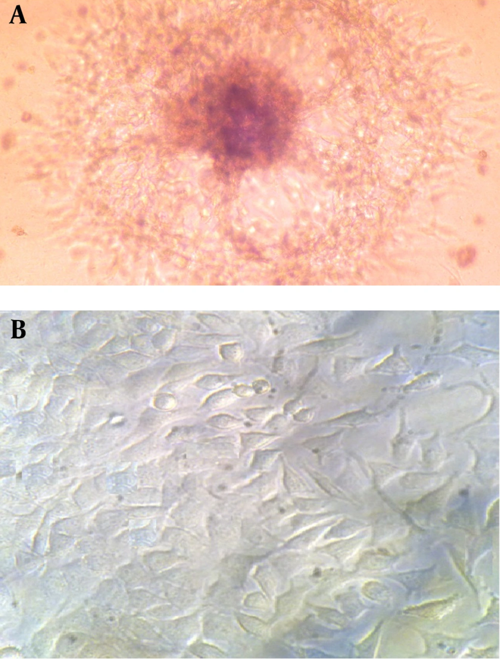 Light Microscopy Evaluation of HepG2 Morphology, After 10 Days of Incubation in A) Fibrin Scaffold 10 × and B) in 2D Routine Polystyrene Matrix 40 × (B) Light Microscopy Evaluation of HepG2 Morphology, After 10 Days of Incubation in A) Fibrin Scaffold 10 × and B) in 2D Routine Polystyrene Matrix 40 × (B)