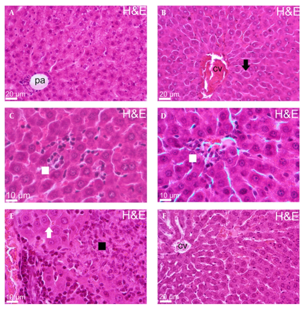 Liver Sections Stained With H&E of all Experimental Groups The liver sections of whole groups named as (A) Control group, (B) Group 2, (C) Group 3, (D) Group 4, (E) Group 5 and (F) Group 6. (Portal area = pa, central vein = cv, black arrow = degenerative hepatocyte, white square = inflammatory cell infiltration, black square = necrotic focus).