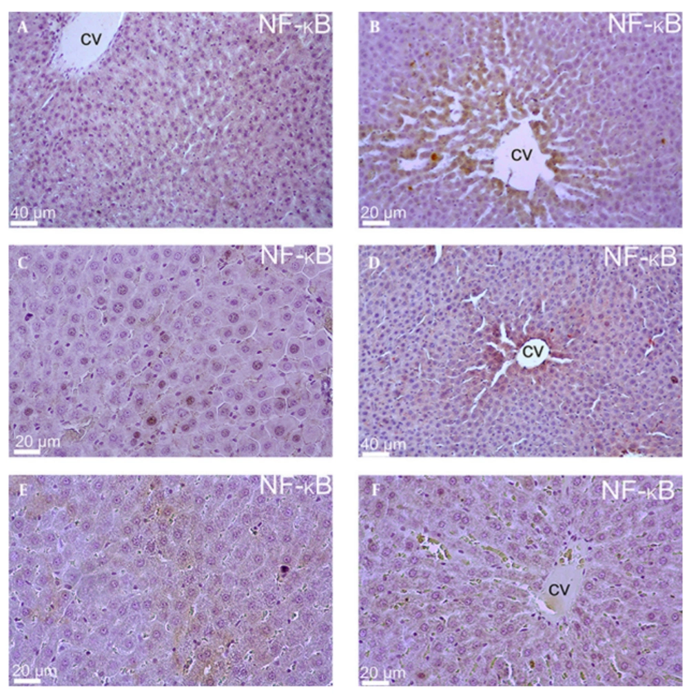 Liver Sections Stained With NF-κB of all Experimental Groups The liver sections of whole groups named as (A) Control group, (B) Group 2, (C) Group 3, (D) Group 4, (E) Group 5 and (F) Group 6. (Central vein = cv).