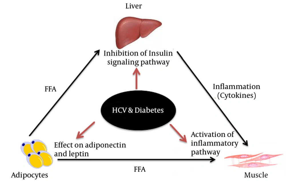 Schematic Presentation of the Association of HCV and Diabetes and the Pathways and Factors Which Mediate Insulin Resistance Synergistically Schematic Presentation of the Association of HCV and Diabetes and the Pathways and Factors Which Mediate Insulin Resistance Synergistically