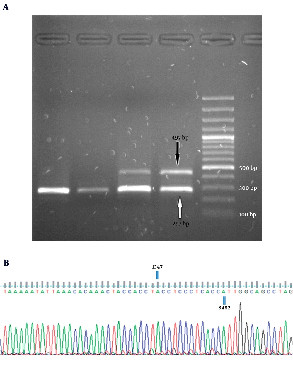 Multiplex-PCR Amplification and Sequencing Results A, electropherograms of multiplex PCR products on a 1.5% agarose gel along with a 100 bp DNA ladder. All subjects produced a single fragment of 279 bp as a control. The appearance of a 497-bp band was an expression of the 4,977-bp deletion; B, schematic presentation of mtDNA 4,977-bp deletion. Sequence analysis performed using the Finch TV 1.4.0 software (Geospiza, Inc., Seattle, WA).