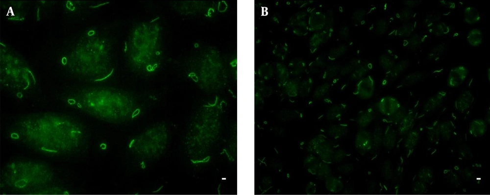 Indirect Immunofluorescence - Hep - 2 Rods and Rings Pattern IIF with a representative anti-Rods and Rings positive HCV patient sample diluted 1/80. A and B, slides from Euroimmun; A, cells with rods and rings conformations at × 40 magnification; B, classical RR at × 10 magnification. Bar, 5µm.