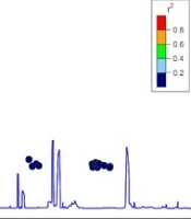 Association Between Periodontitis and NAFLD-Related Diseases: Results from the NHANES and Mendelian Randomization Study