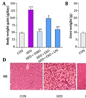 Comparative Therapeutic Effects of LPS-Primed MSC-Derived Exosomes and Saroglitazar in a Wistar Rat Model of Non-Alcoholic Steatohepatitis via AMPK/ACC Signaling Modulation