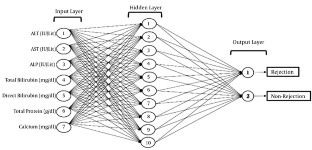 Architecture of the Neural Networks Used in the Present Study The network consists of three layers, with 7 neurons in the input layer, 10 neurons in the hidden layer, and 2 neurons in the output layer. AST, aspartate aminotransferase; ALP, alkaline phosphatase; ALT, alanine aminotransferase.