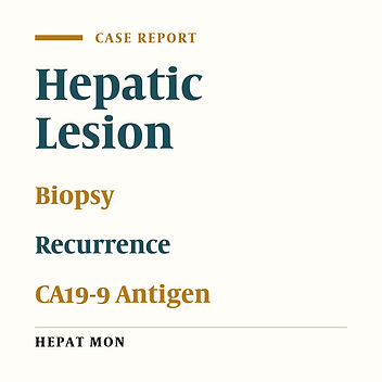 Coincidental Occurrence of Hepatocellular Carcinoma and Cholangiocarcinoma (Collision Tumors) After Liver Transplantation: A Case Report