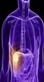 PIB: A Score to Select Sorafenib Treatment Candidates for Hepatocellular Carcinoma in Resource-Limited Settings