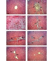 Effects of Hydroalcoholic Leaf Extract of Avicennia marina on Apoptotic, Inflammatory, Oxidative Stress, and Lipid Peroxidation Indices and Liver Histology of Type 1 Diabetic Rats