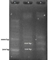 Detection of Human Papillomavirus 33 in Erosive Oral Lichen Planus