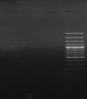 Diagnostic Evaluation of Streptococcus gallolyticus Infection in Patients with Colon Diseases by Polymerase Chain Reaction (PCR) and Culturing Methods
