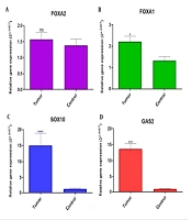FOXA1, FOXA2, SOX10 and GAS2 Gene Expression in Oral Squamous Cell Carcinoma and Their Relationship with Clinicopathological Indices