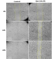 Quercetin Improves the Anti-angiogenic Property of 5-Fluorouracil on the Human Umbilical Vein Endothelial Cells HUVEC Cell Line