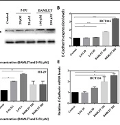 The Comparative Role of BAMLET and 5-Fluorouracil in Colorectal Cancer Cells by Targeting WNT/β-Catenin Pathway