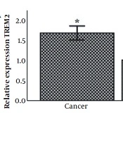 Expression Analysis of TREM2 and TC2N Genes in Human Breast Cancer Tissues