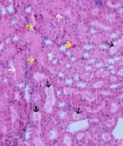 Antioxidant Activity of Cichorium intybus Extract in Concomitant Use with Melatonin Against Doxorubicin-induced Nephrotoxicity