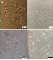 Deletion of the Long Non-coding RNA ANRIL In Addition to the Protein-Coding Genes of the INK4-ARF Locus in the A549 Cell Line: An Existing Phenomenon or a Novel Genetic Alteration?